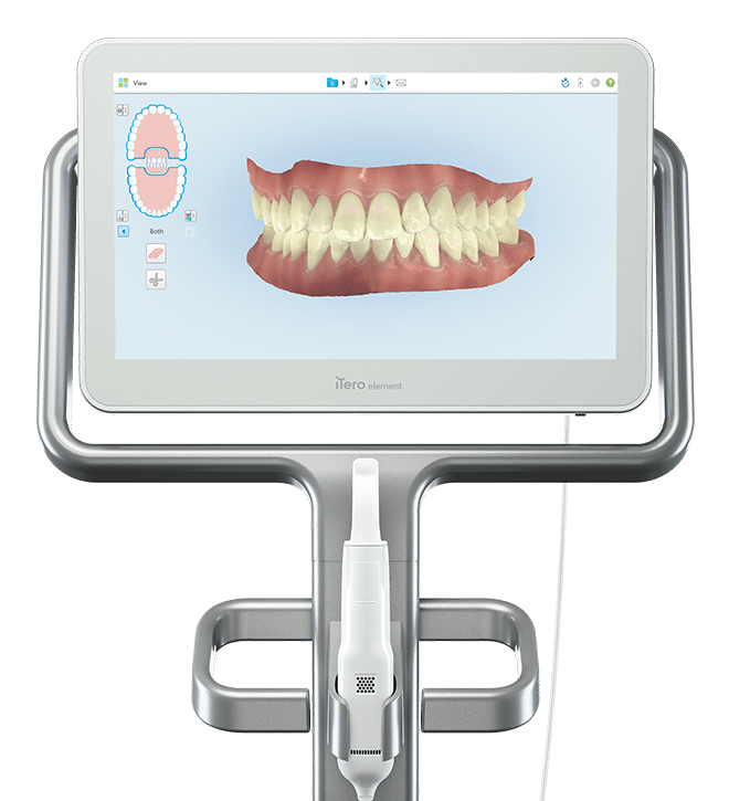 invisalign profile